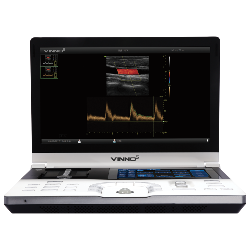 VINNO 5 - Mobiles Ultraschallgerät